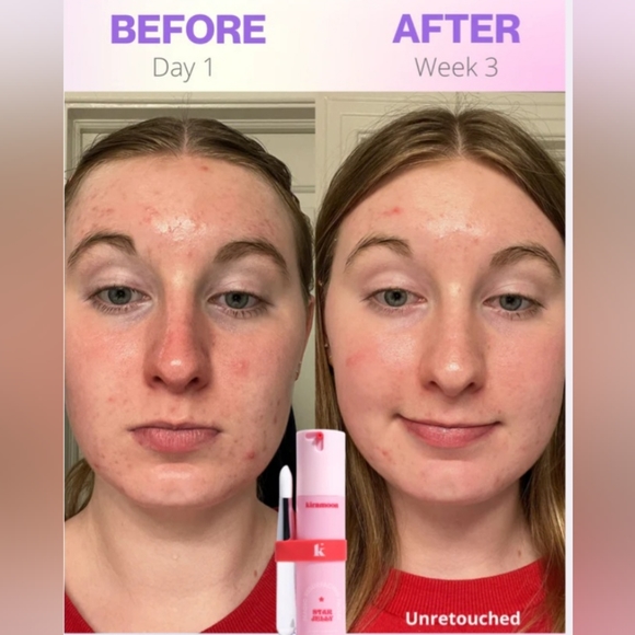 Kiramoon Star Jelly Magic Resurfacing Facial Mask - Picture 4 of 5